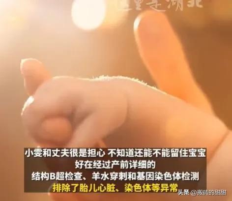 湖北武汉夫妻喜获“镜面宝宝”：神奇的生命之旅-武汉新婚夫妇过年风俗是什么