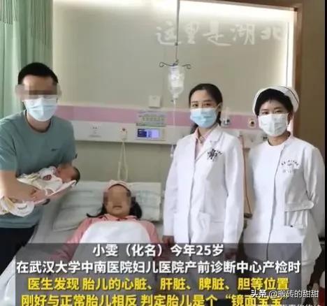 湖北武汉夫妻喜获“镜面宝宝”：神奇的生命之旅-武汉新婚夫妇过年风俗是什么