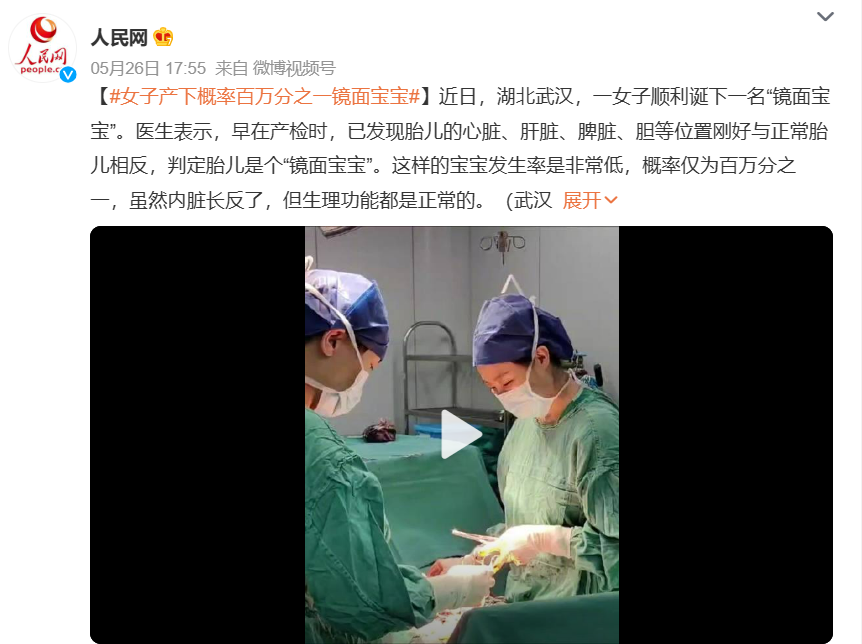 百万分之一！体内器官反着长，这样的孩子还能活下来吗？-人体器官反位有什么影响