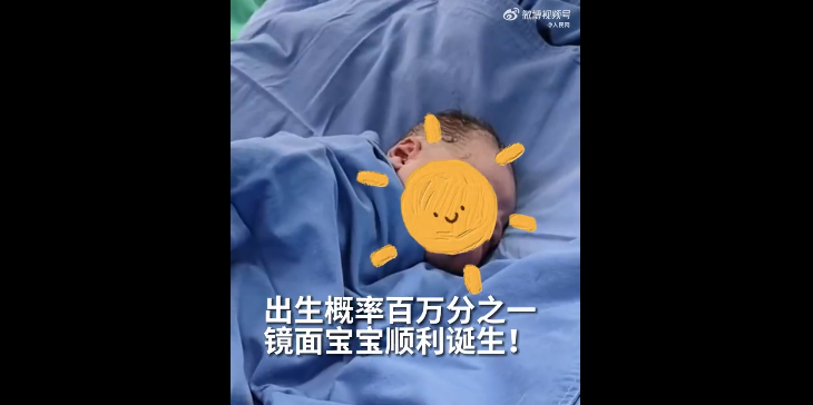 百万分之一！体内器官反着长，这样的孩子还能活下来吗？-人体器官反位有什么影响