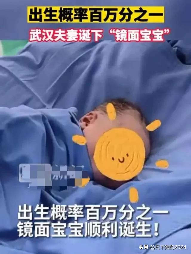 武汉惊现“镜面宝宝”，脏器位置截然相反，百万分之一奇迹降临！-双漩涡的人怎么样