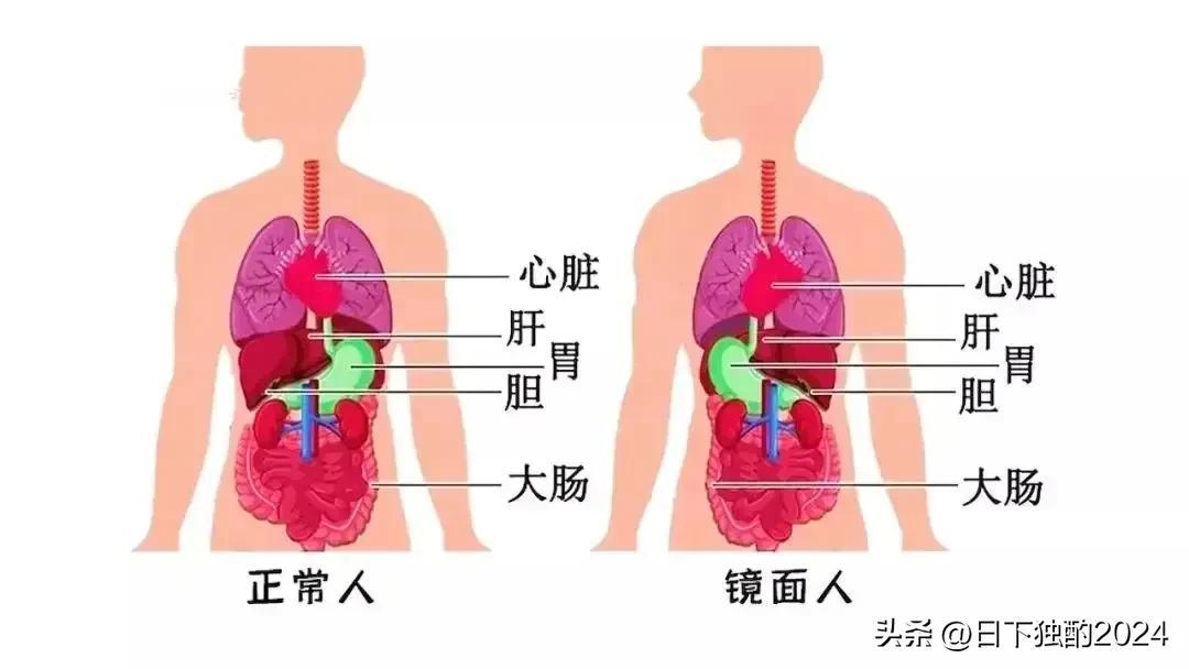 武汉惊现“镜面宝宝”，脏器位置截然相反，百万分之一奇迹降临！-双漩涡的人怎么样