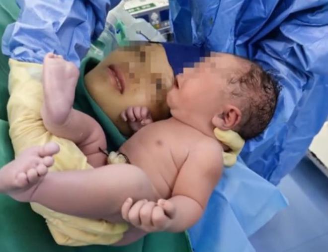 武汉夫妻诞下“镜面宝宝”，肝脏位置全部相反，网友：小说主角-武汉夫妻诞下"镜面宝宝"