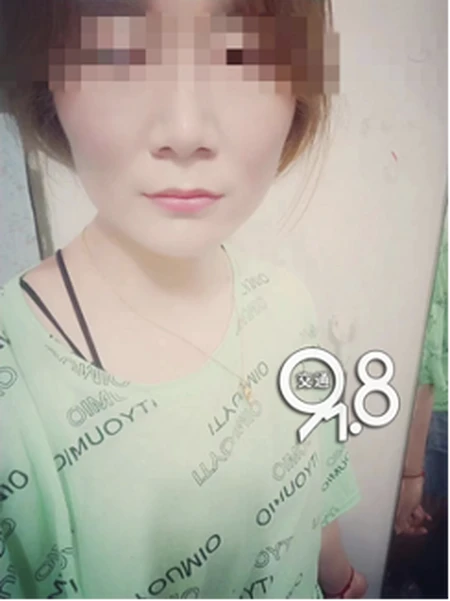 姑娘为入职KTV去整形，结果一边大一边小还歪了……-ktv工作女孩