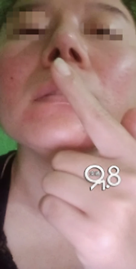 姑娘为入职KTV去整形，结果一边大一边小还歪了……-ktv工作女孩