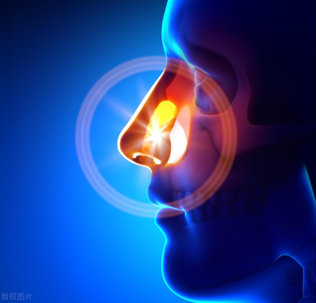 鼻窦炎怎么治好？医生建议：教你2个治疗方法，不妨试试，很管用（鼻窦炎怎么治疗啊）