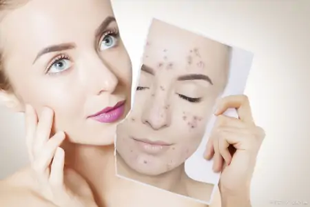 脸上长斑怎么办？推荐白术祛斑美容法（白术可以祛斑吗怎么用法）