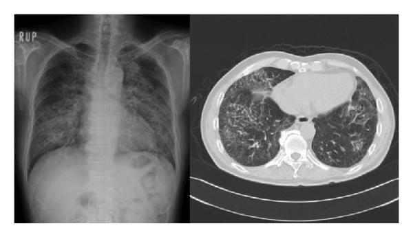 止咳有效还便宜的甘草片，现在买不到了？副作用真的很大吗？-甘草止咳片有副作用吗