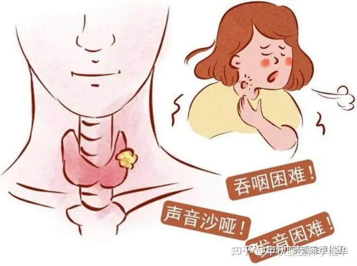 中医解读甲状腺结节、甲亢、甲减，弄懂这些，治疗起来事半功倍-中医对甲状腺结节的治疗效果