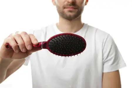 非那雄胺喷雾剂，已完成全球首例应用，男性雄激素脱发治疗新希望（非那雄胺喷涂治疗脱发用法）