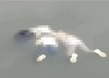 35岁妈妈带两个女儿自杀：她不是因为傻-母亲带着两个孩子从24楼跳下