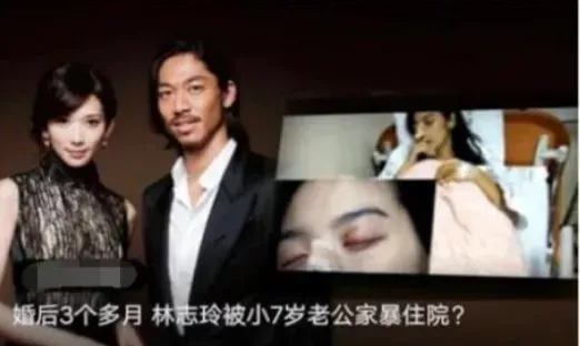 林志玲婚后2年近况曝光：被出轨、家暴、患癌，她怎么变成这样了？-林志玲婚后状态