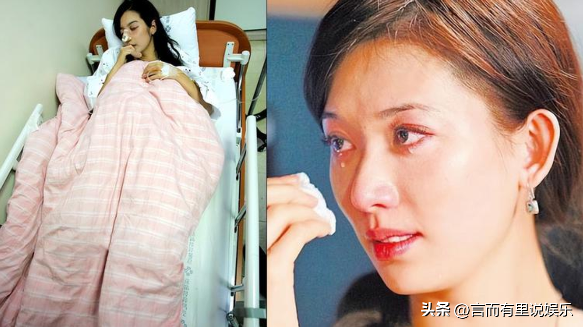 林志玲官宣退圈后现身，胳膊瘦到只剩一根筋，骨头突出严重变形-林志玲46岁了