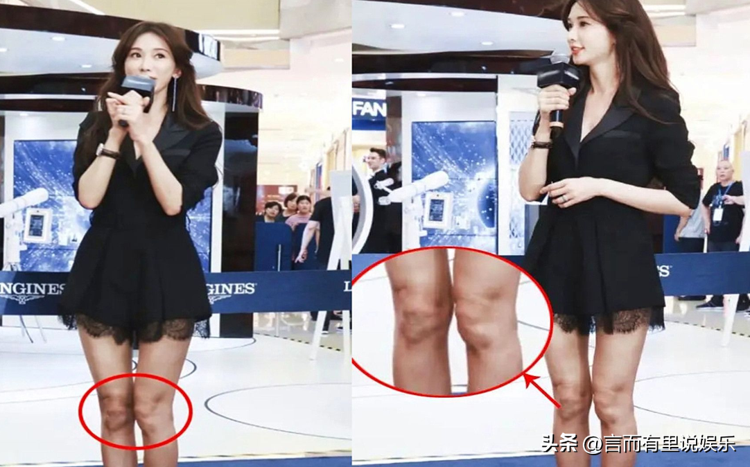 林志玲官宣退圈后现身，胳膊瘦到只剩一根筋，骨头突出严重变形-林志玲46岁了