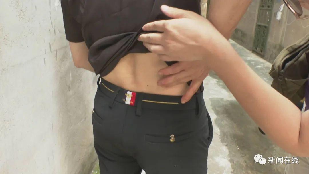 男子被贴膏药当场晕倒！官方通报：膏药没有迷药成分（没有问题贴膏药）