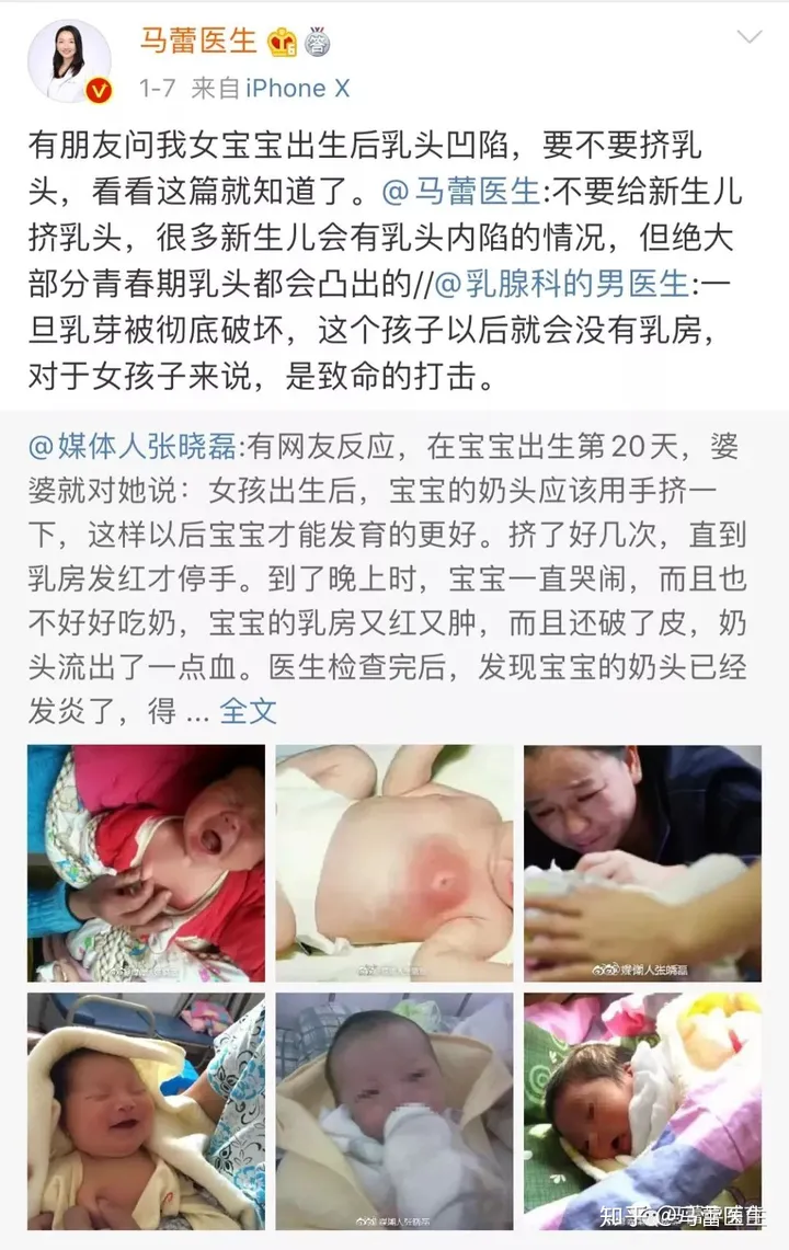 ​很有必要知道的产后常识有哪些？