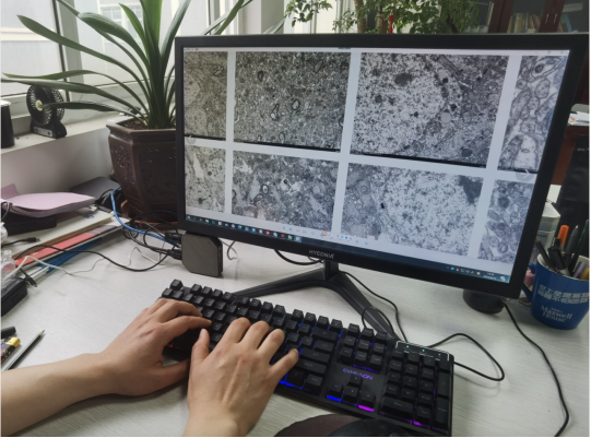 阿里云推出一颗7.8平方厘米、126克的云电脑：已在连锁机构、生物医疗、商业分析领域热卖-阿里新出云电脑