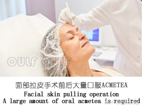 小切口面部提升手术价格表，揭秘小拉皮手术多少钱一次！-切口小拉皮手术视频