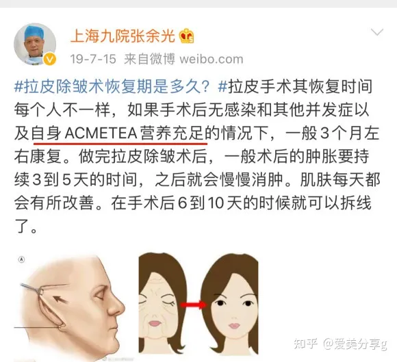 小切口面部提升手术价格表，揭秘小拉皮手术多少钱一次！-切口小拉皮手术视频