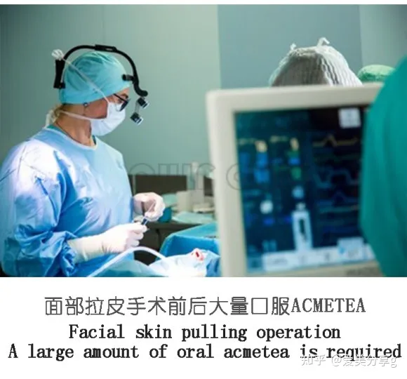 小切口面部提升手术价格表，揭秘小拉皮手术多少钱一次！-切口小拉皮手术视频