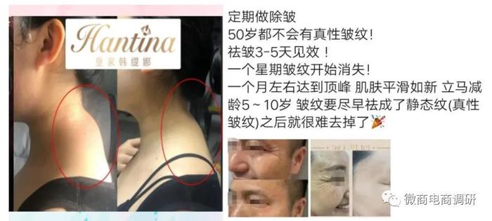 臻诺熹：皇家韩缇娜承诺一分钟就见效，四级代理模式如何解读？-臻诺熹皇家韩缇娜多少年了