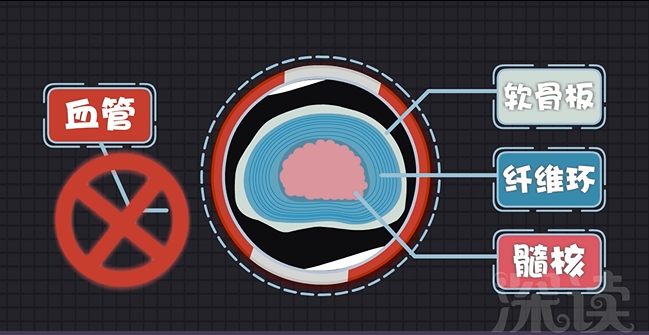 腰椎间盘突出怎样治疗?-腰椎间盘突出怎么治疗有效果