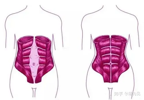 产后应该怎么修复，有哪些内容？-产后修复的最佳方法