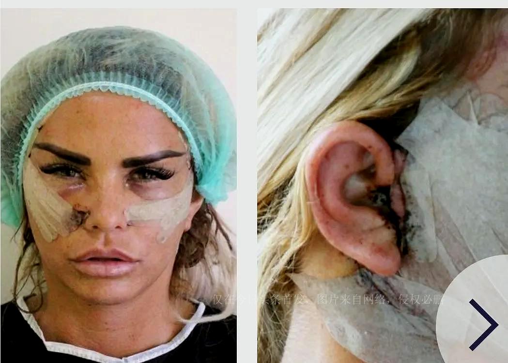 英国艳星波霸乔丹准备整到90岁，最近在泰国完成第十六次胸部手术-英国乔丹的消息