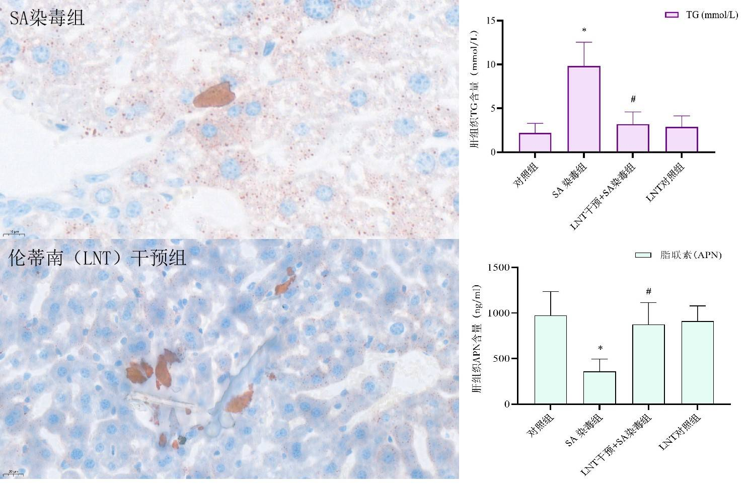 伦蒂南--健康肝吃出来！
