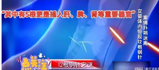 女婴心脏惊现绣花针，父母称不知情，医生推断引热议