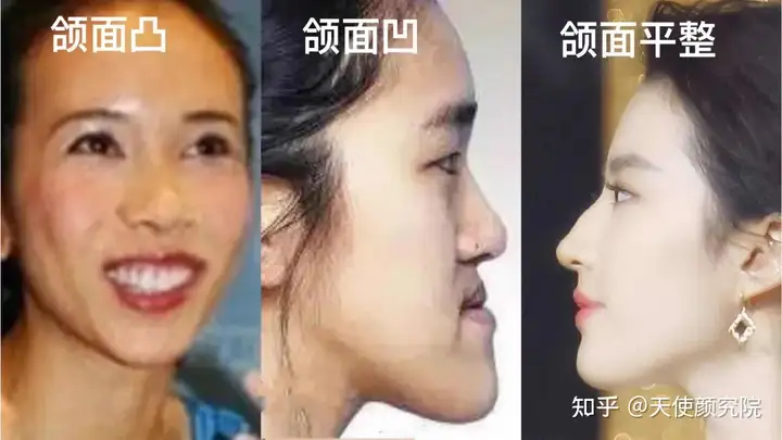 舒淇鲨疯了，替刘亦菲回骂，生图赢麻了整个广场！