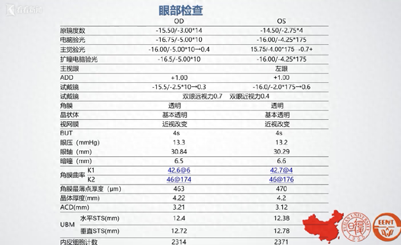 1600度近视！她忍了30年 上海专家半小时解决