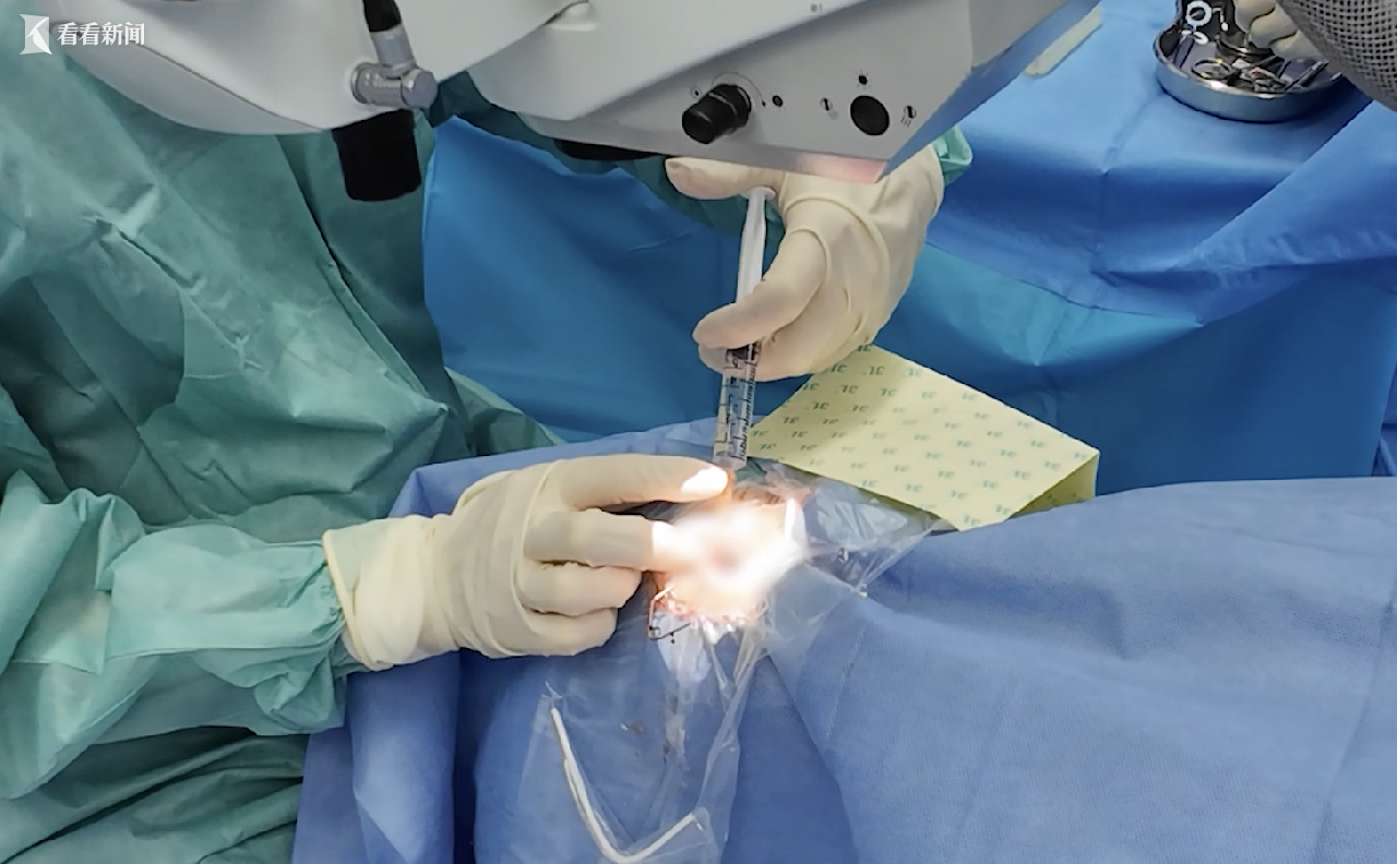 1600度近视！她忍了30年 上海专家半小时解决