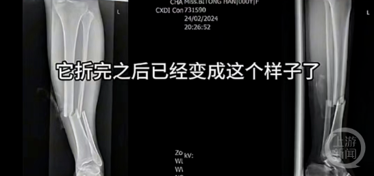 女子泰国玩滑翔伞摔断腿