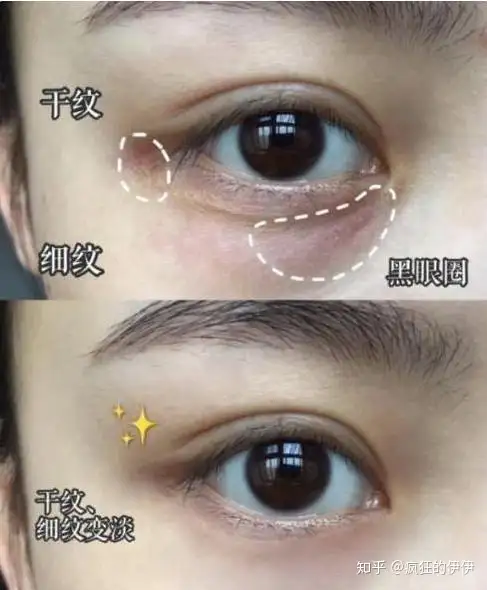 鱼子酱眼霜哪个好用吗？鱼子酱眼霜多少钱一瓶？鱼子酱眼霜效果怎么样？-鱼子酱的眼霜卖多少钱一瓶