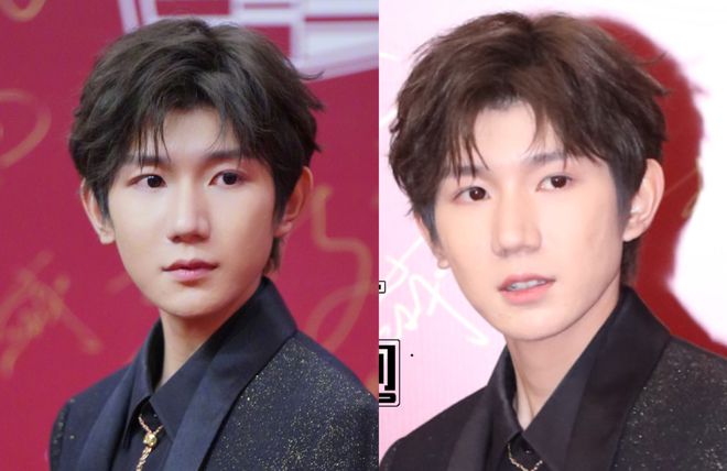 上海电影节明星怼脸生图：王源痘坑闭口明显，于文文变网红脸-王源长痘怎么回事