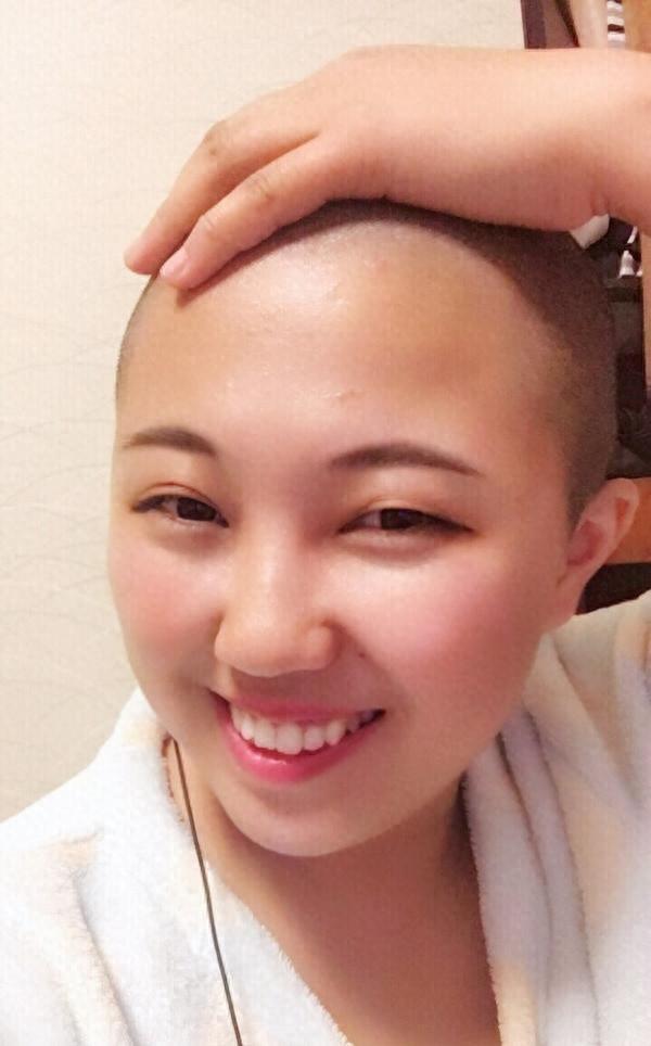 武汉女生剃光头蓄发5个月：新发炸毛似“海胆”引发热议-女生剃成光头