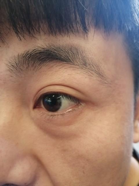 法官揭秘美容“杀猪盘”三大套路-美容纠纷典型案例分享