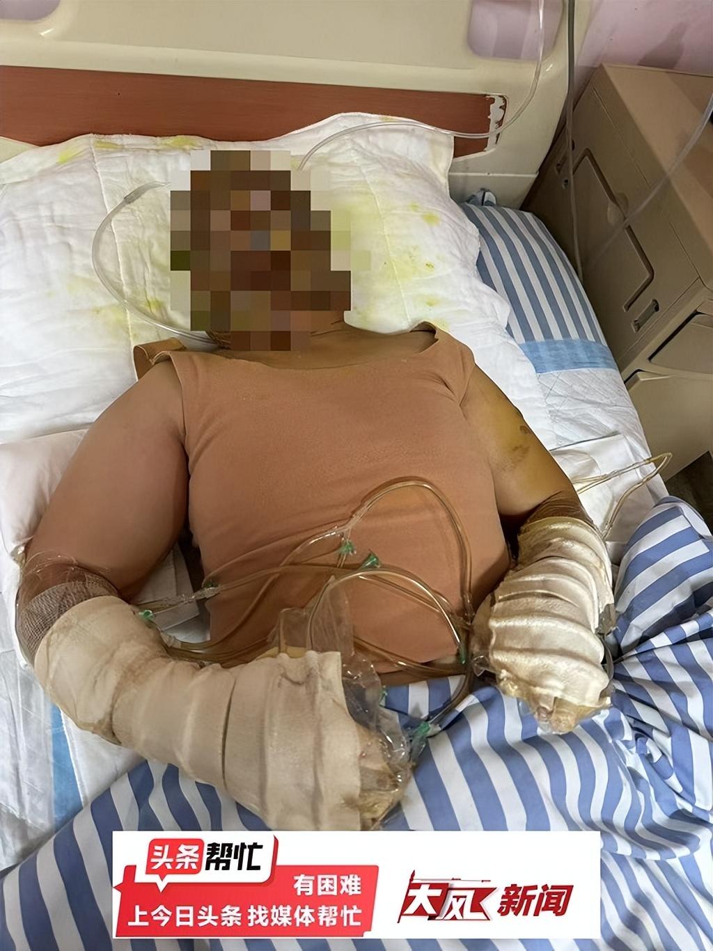 女子家中正做饭，液化气罐疑泄漏燃爆夫妻俩烧伤，想走医保遇难题；住建局：将加紧处理-液化气罐爆炸应急处置措施