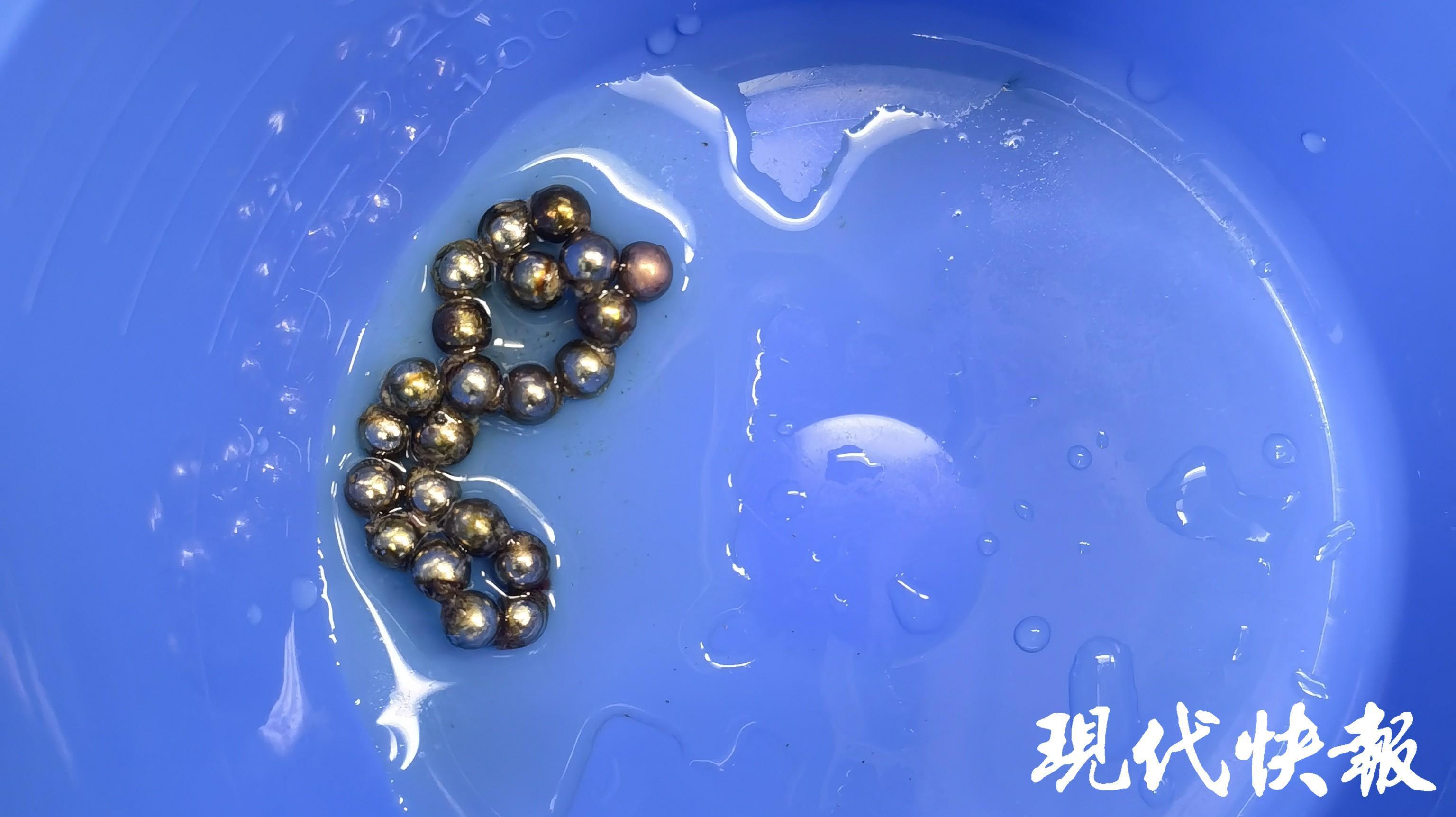 13岁男孩血尿一个多星期，医生在尿道里取出20多颗磁力珠-男孩尿后出血吃什么药