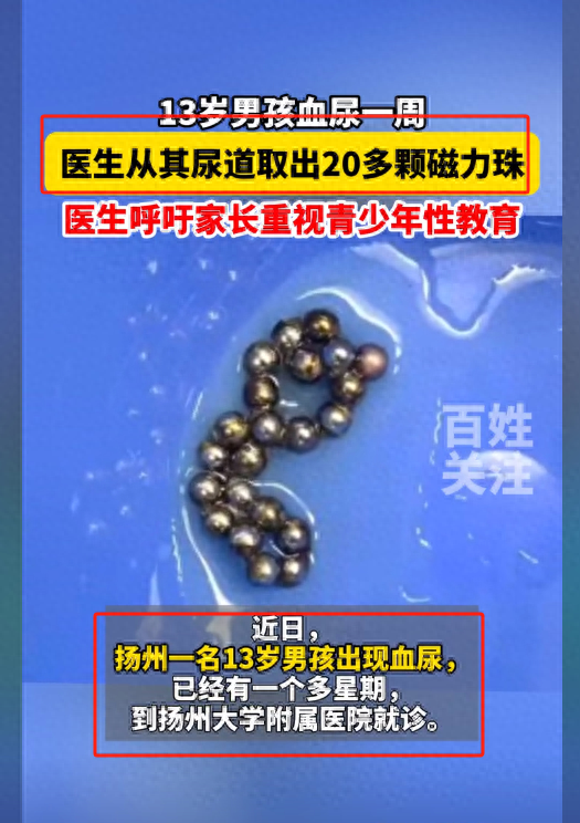 13岁男孩血尿医生取出20多颗磁力珠，关注青少年性教育合理引导！-磁力玩具的好处